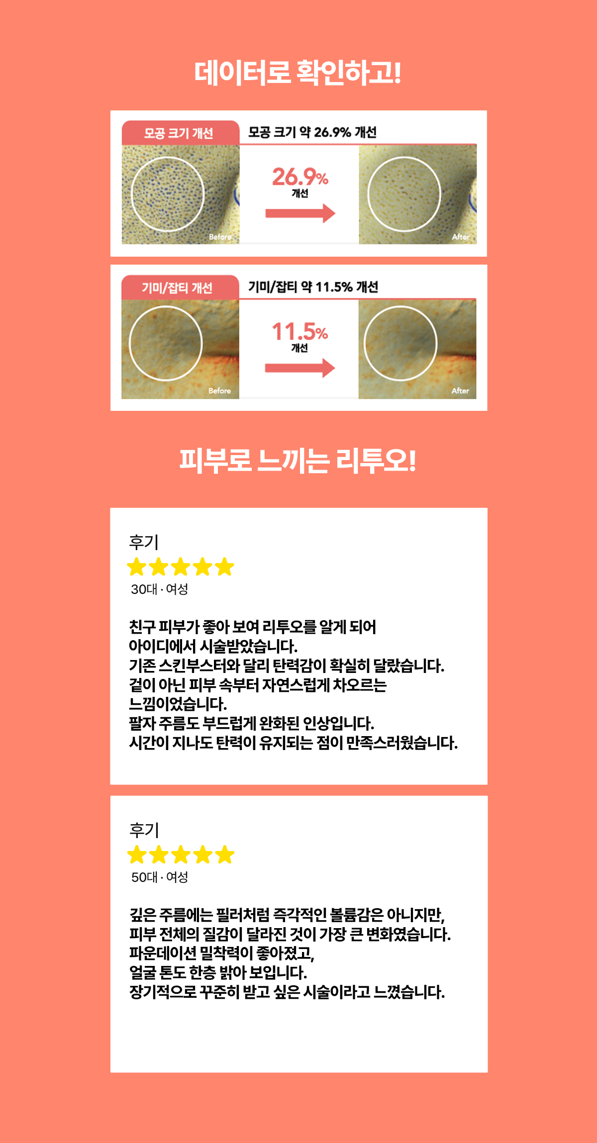 모공 크기, 기미/ 잡티 개선을 데이터로 확인하고 후기로 증명하는 라투오
