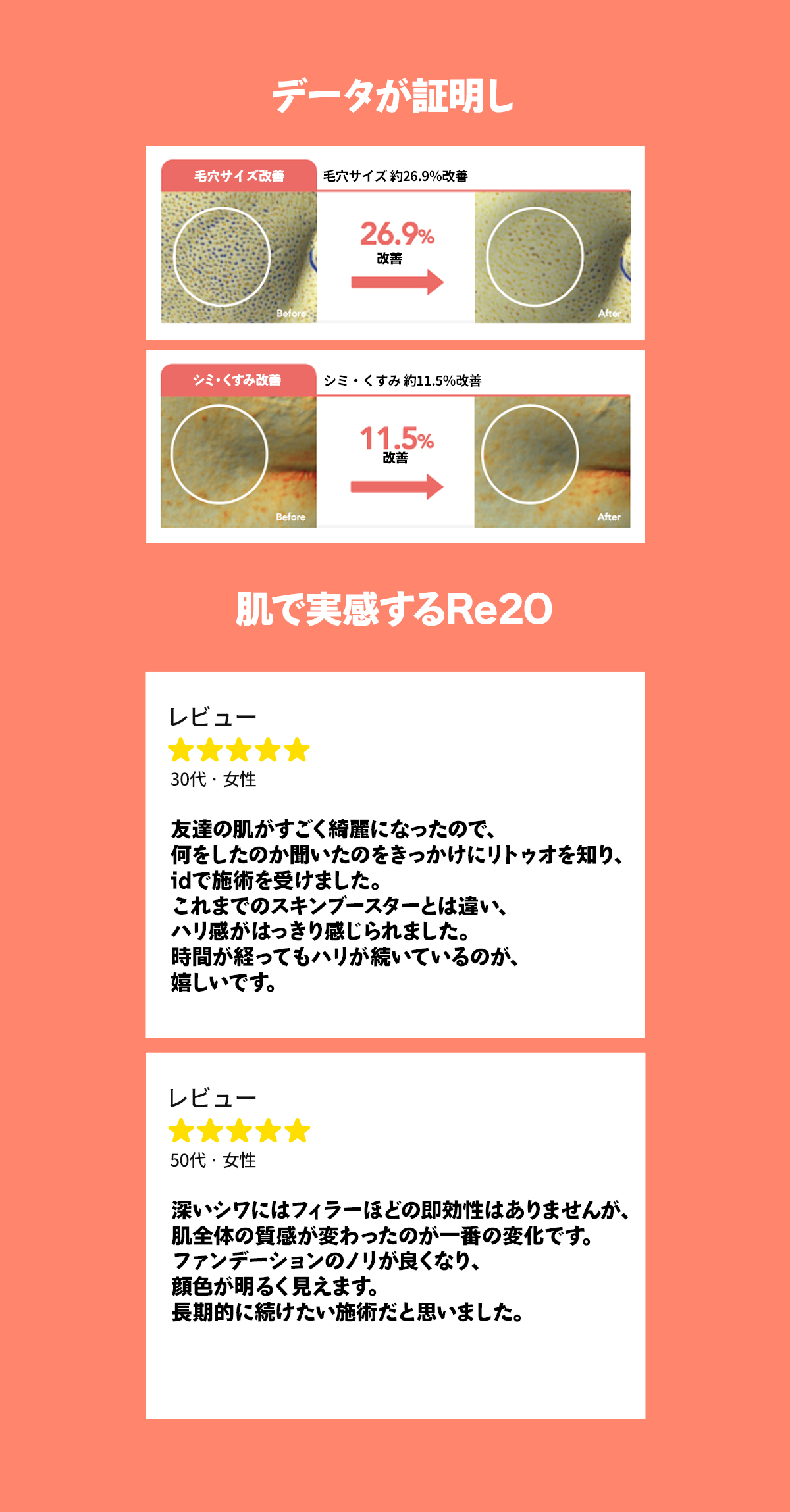 データが証明し肌で実感するリトゥオ(Re2O)
