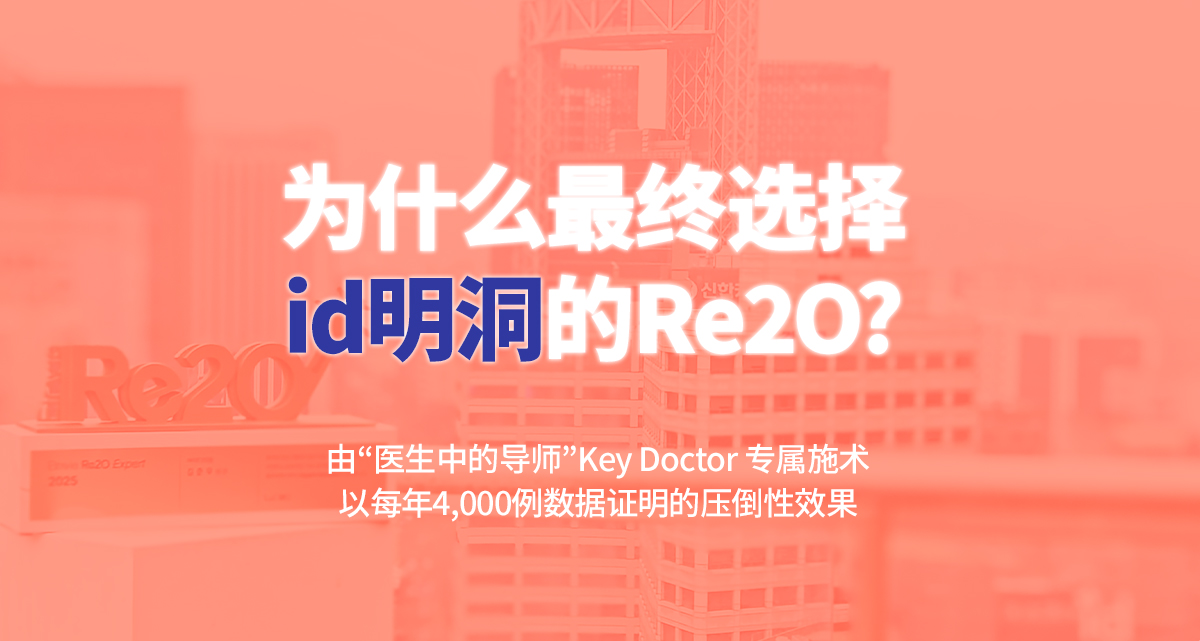 为什么最终选择 id 明洞的 Re2O？